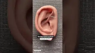 Ear Shen Men Acupuncture Point #acupuncturepoints