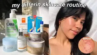 MY Differin Gel Skincare Routine