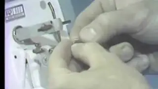 Техника ортодонтической точечной сварки