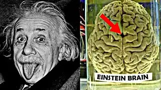 How Einstein's Brain was Different ?