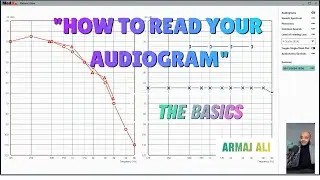 How To Read Your Audiogram (The Basics)