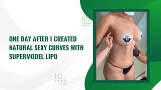 ONE DAY AFTER I CREATED NATURAL SEXY CURVES WITH SUPERMODEL LIPO | Dr. Jason Emer