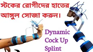 স্ট্রোক পরে রোগীর হাতের আঙ্গুল শক্ত হলে কি করবেন।#dynamic_Cock_Up_Splint#Radial_Nerve_palsy dynamic