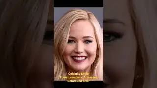 Celebrity Smile Transformations: Actresses Before and After