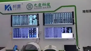 Medical Dry Imaging Xray Film +86 18237737138