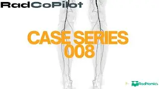 Case 008 | RadCoPilot in Action: Mesenteric Mass