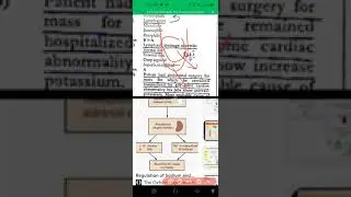 Fcps Past papers from Sk series Double A book Cpsp repeated Questions in Fcps exam