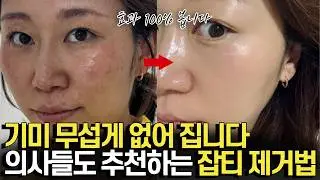 매일 밤 비타민C 이렇게 바르면 기미 무섭게 없어집니다