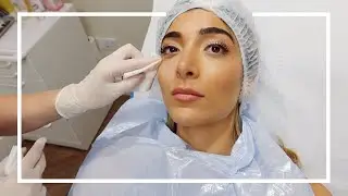 WHAT I'VE HAD DONE TO MY FACE...Pre-Holiday Glow Up | Amelia Liana