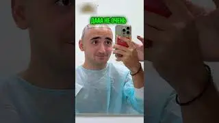 😱 Я СДЕЛАЛ ПЕРЕСАДКУ ВОЛОС!