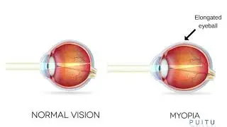 Human eye and The Colourful World Mizo Explanation | Physics Mizo Explanation