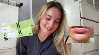 STORYTIME - esté producto me quemó la cara *creo*