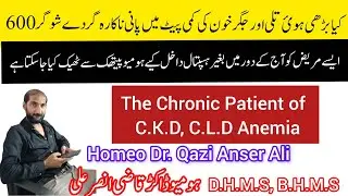 My Clinical Cases, A Chronic Case of CLD CKD, Anemia, spleenomegaly cured with #homeopathicmedicine 