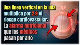Una linea vertical en la una multiplica por 2punto9 el riesgo cardiovascular La alarma nutricional q