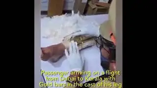 A passenger from Dubai to Kerala India had a leg in &ldquo;Cast&rdquo; and was limping. Customs was suspicious.