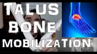 Got Ankle Impingement?  Do Talus Bone Mobilization!