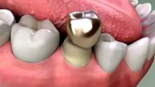 Dentist - Tooth Restoration Treatments