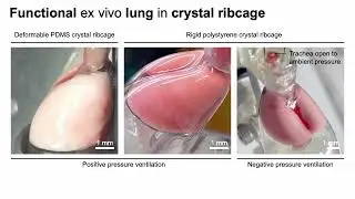 Crystal ribcage - rigid vs semi-flexible; negative- vs positive-pressure ventilation