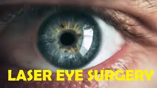 does laser eye surgery permanently fix eyesight
