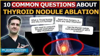 10 Common Questions About non surgical treatment of Thyroid Nodules (RFA) | Dr. Gaurav Gangwani (IR)