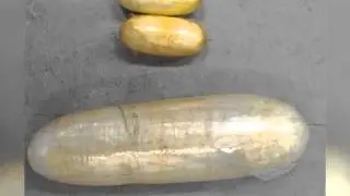 Guyana&rsquo;s customs finds cocaine in St. Lucian women&rsquo;s private parts | CEEN News | Nov 19, 2015