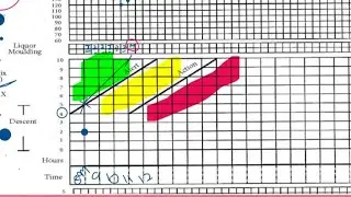 The Partograph Decoded Part 2 :Partograph Filling and Interpretation @Love_Obs_Gynae 