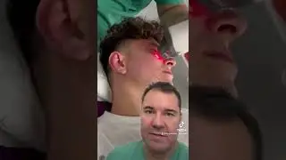 Scar War&rsquo;s: Fraxel-Laser gegen Aknenarben #fraxel #laser #aknenarben #expert