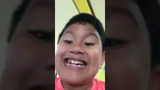 Wub2
