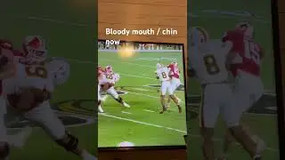 I wonder if he is ok