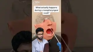 how a nasal swab is done #shorts #reaction  #nose #medicalreaction