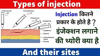इंजेक्शन कितने प्रकार के होते हैं और कहां कहां लगाया है? | types of injection and their sites