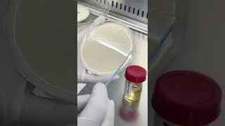 Urine Culture: Diagnosing Urinary Tract Infections | Lab Test Process #urine #shortvideo #science