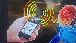 ##anti Radiation chip##abo life care ##