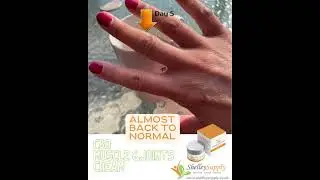 See how Muscle & Joints Cream with high strength CBD heal sports injury