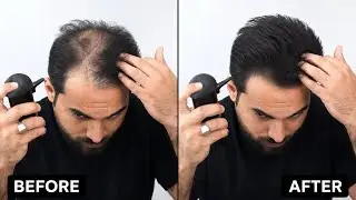How to cover up thin & receding hairline by Hair Building Fibers ( THICK FIBER)