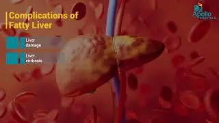 Fatty Liver Detection & Management at Apollo&rsquo;s Dedicated Clinic | Dr Murugan N| Apollo Hospitals