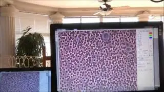 Dr. Hugh Smith Applies Pain Chip to Live Blood Sample