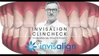 Invisalign ClinCheck - Vorraussetzungen, Ablauf & Beispiel