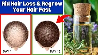 7 Home Remedies to Prevent Hair Loss and Regrow Your Hair Faster