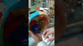 FOSA CRANEAL POSTERIOR