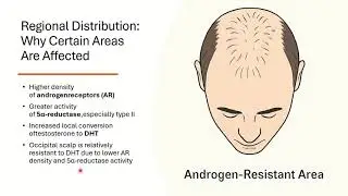 androgenetic alopecia part  1