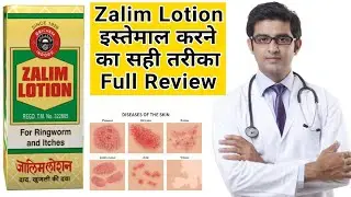 Zalim lotion fungal treatment | Zalim lotion for fungal infection | Zalim Lotion Use in Hindi