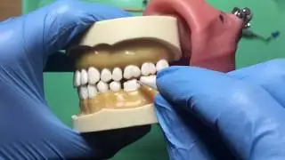 Checking Occlusal Clearance in the NDEB ACS Exam