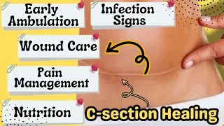 FASTER HEALING Post C-SECTION / PAIN/ SCAR MASSAGE / WOUND CARE / INFECTION SIGNS...