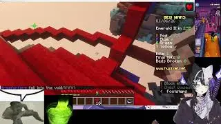 random mc stream but I got my wisdom teeth removed