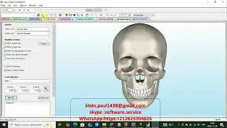 Gamma Dental 42.9.0.225 – New Features & Performance Test