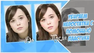 Убираем недостатки с помощью 