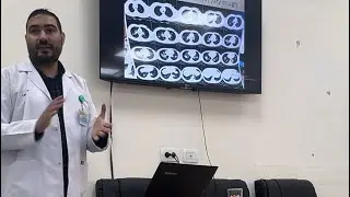 Systemic sonar in chest diseases