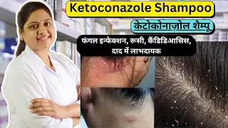 डेन्डरफ, रूसी का ईलाज - Ketoconazole Shampoo - Ketoconazole Shampoo Uses In Hindi