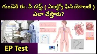 EP Heart Test procedure in Telugu| గుండెకి ఎలక్ట్రో ఫిసియోలజీ పరీక్ష ఎలా చేస్తారు .